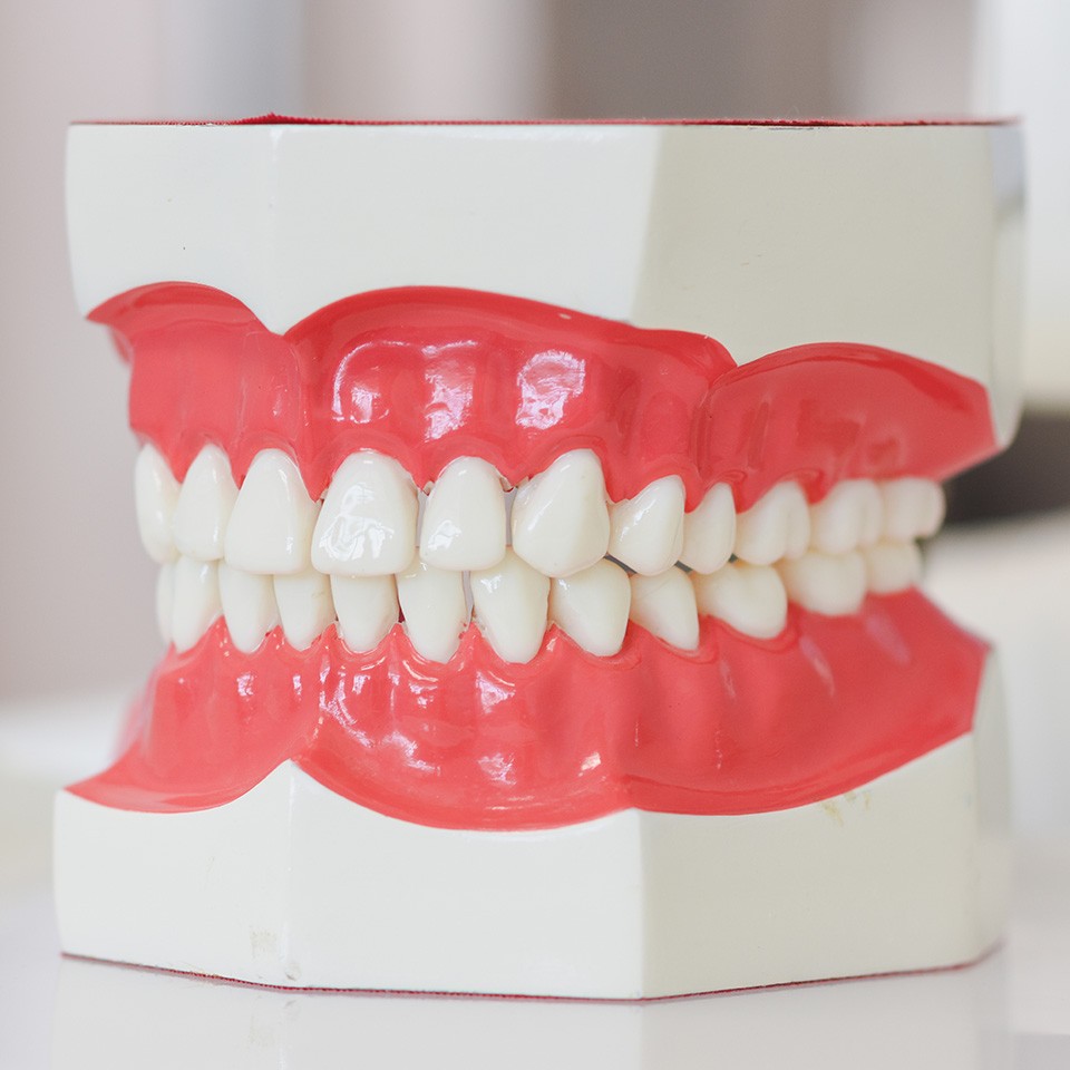 dentures are made in a multi-step process to customize them to your mouth